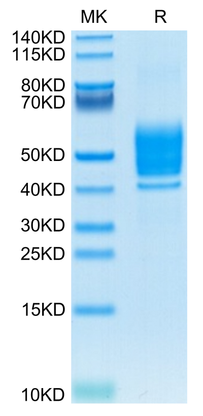 Mouse PSCA on Tris-Bis PAGE under reduced condition. The purity is greater than 95%.Recombinant Mouse PSCA-Protein