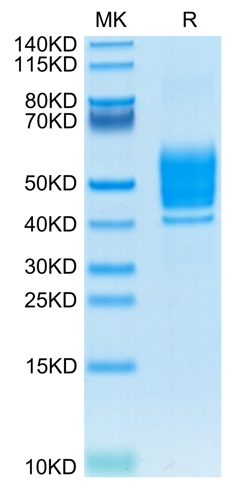 Mouse PSCA on Tris-Bis PAGE under reduced condition. The purity is greater than 95%.Recombinant Mouse PSCA-Protein
