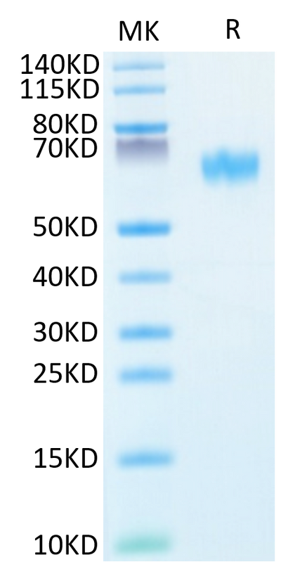 Human NOGOR on Tris-Bis PAGE under reduced condition. The purity is greater than 95%.Recombinant Human NOGOR Protein, Active