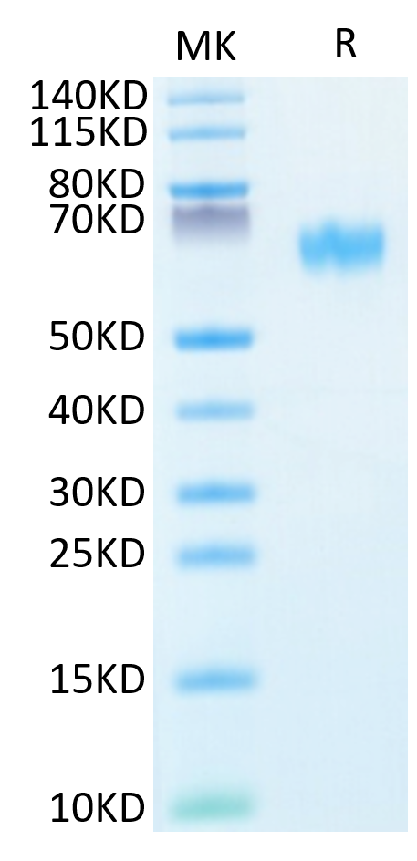 Human NOGOR on Tris-Bis PAGE under reduced condition. The purity is greater than 95%.Recombinant Human NOGOR Protein, Active