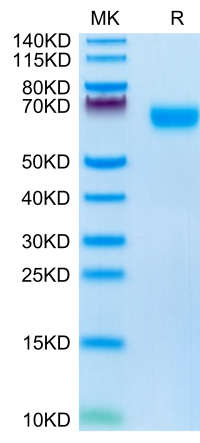 Mouse NOGOR on Tris-Bis PAGE under reduced condition. The purity is greater than 95%.Recombinant Mouse NOGOR Protein