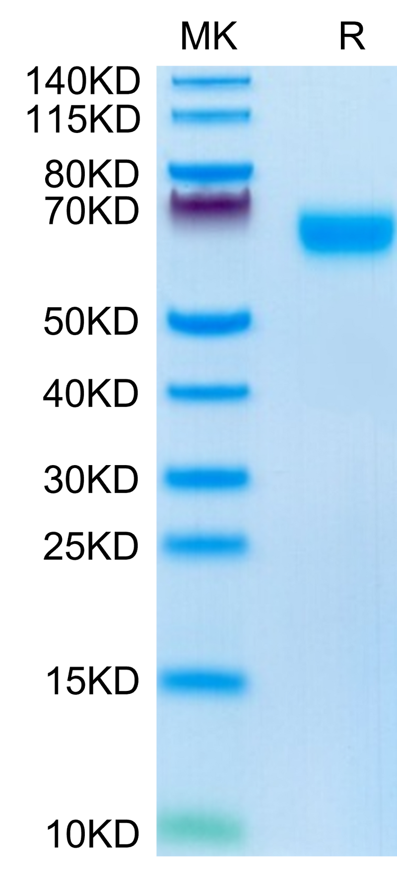 Mouse NOGOR on Tris-Bis PAGE under reduced condition. The purity is greater than 95%.Recombinant Mouse NOGOR Protein