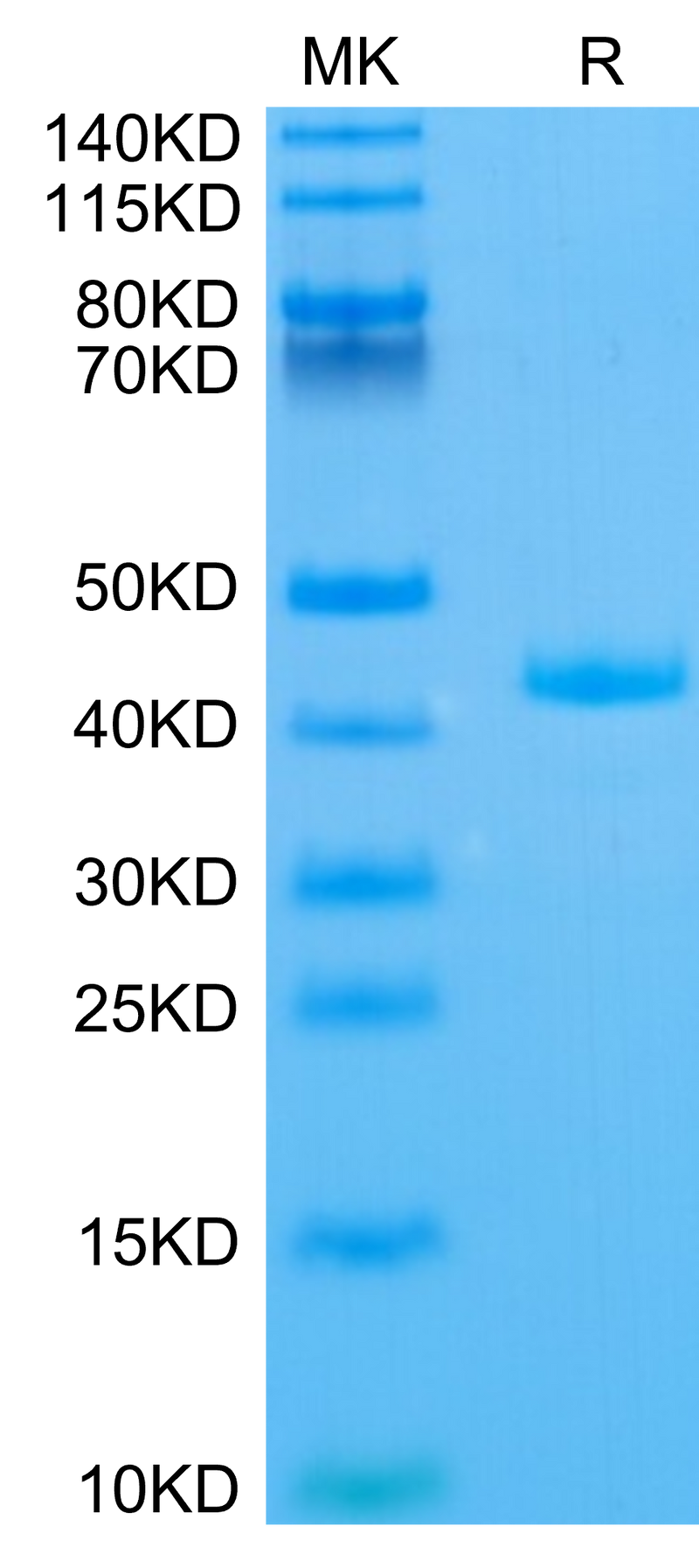 Human APOA2 on Tris-Bis PAGE under reduced condition. The purity is greater than 95%.Recombinant Human APOA2 Protein