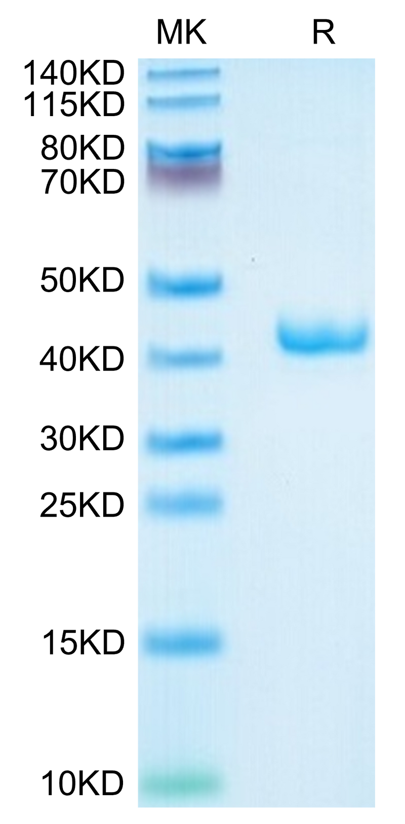 Mouse APOA2 on Tris-Bis PAGE under reduced condition. The purity is greater than 95%.Recombinant Mouse APOA2 Protein