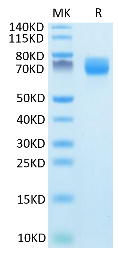 Mouse ARTN on Tris-Bis PAGE under reduced condition. The purity is greater than 95%.Recombinant Mouse ARTN Protein, Active