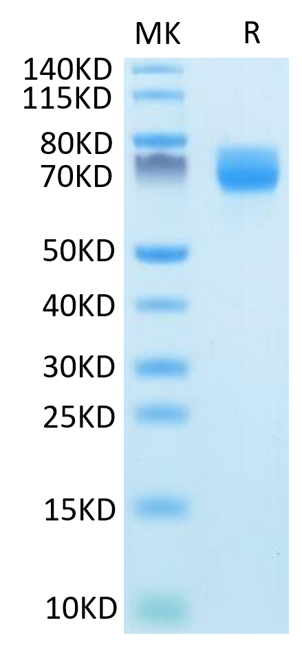 Mouse ARTN on Tris-Bis PAGE under reduced condition. The purity is greater than 95%.Recombinant Mouse ARTN Protein, Active