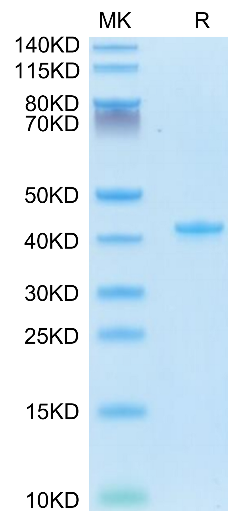 Mouse CCL5 on Tris-Bis PAGE under reduced condition. The purity is greater than 95%.Recombinant Mouse CCL5 Protein
