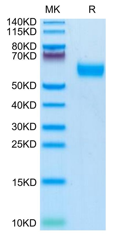 Mouse IL-1R3 on Tris-Bis PAGE under reduced condition. The purity is greater than 95%.Recombinant Mouse IL-1R3/IL-1 RAcP Protein