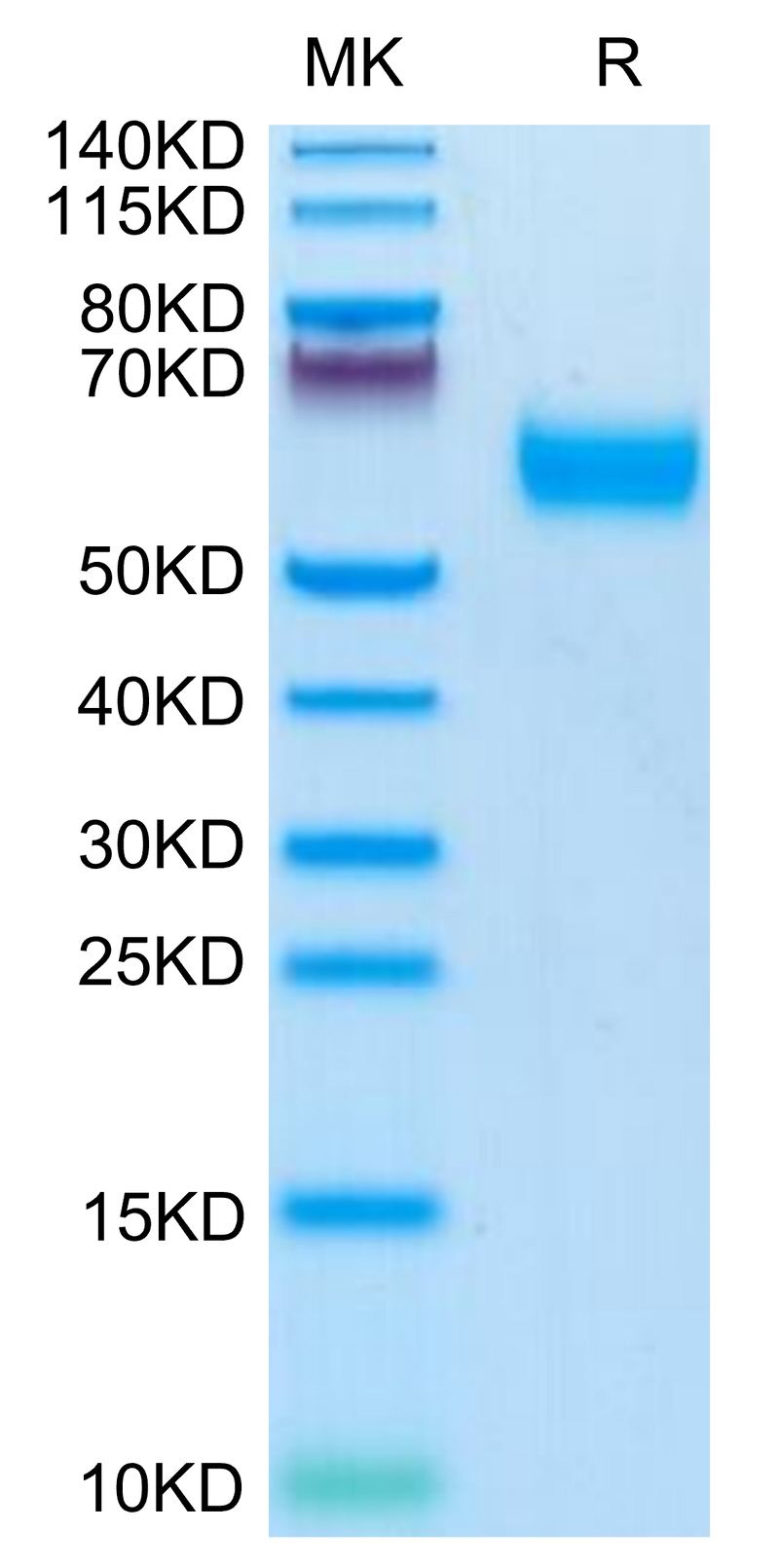 Mouse IL-1R3 on Tris-Bis PAGE under reduced condition. The purity is greater than 95%.Recombinant Mouse IL-1R3/IL-1 RAcP Protein