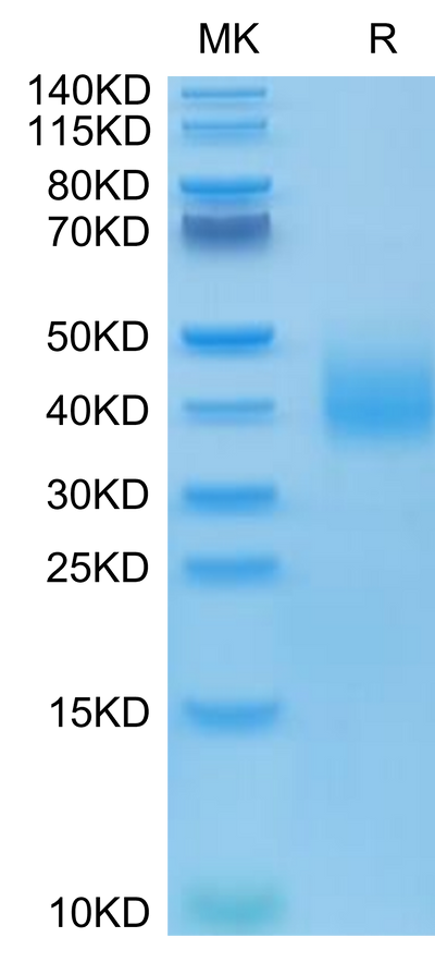 Human SLAMF6 on Tris-Bis PAGE under reduced condition. The purity is greater than 95%.Recombinant Human SLAMF6/NTB-A Protein, Active