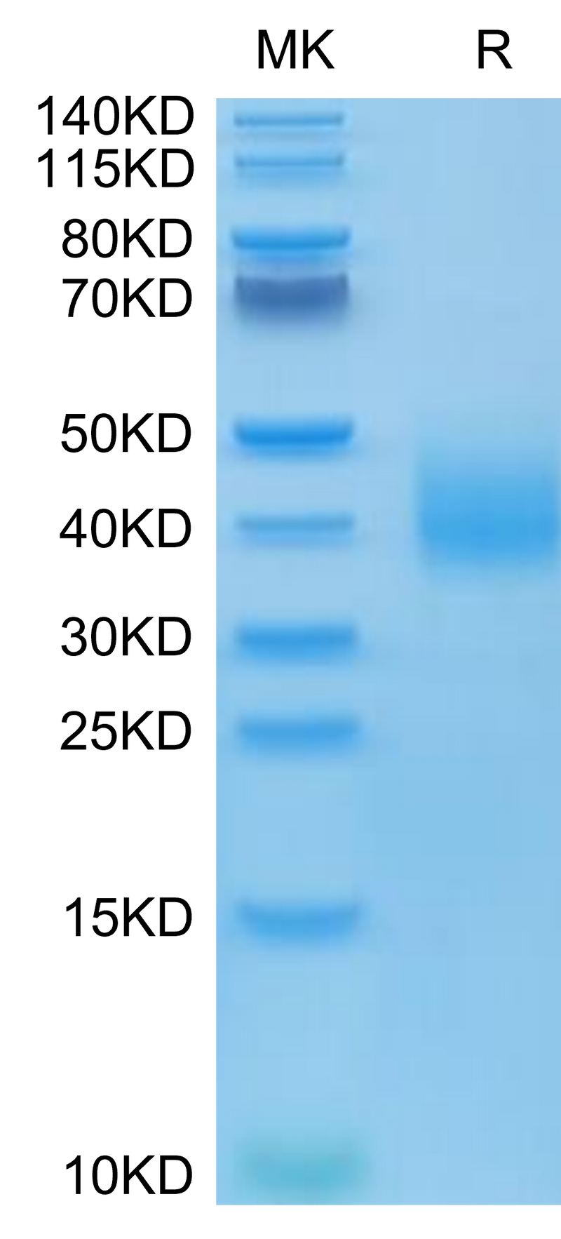 Human SLAMF6 on Tris-Bis PAGE under reduced condition. The purity is greater than 95%.Recombinant Human SLAMF6/NTB-A Protein, Active