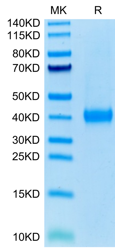 Human JAML on Tris-Bis PAGE under reduced condition. The purity is greater than 95%.Recombinant Human JAML Protein