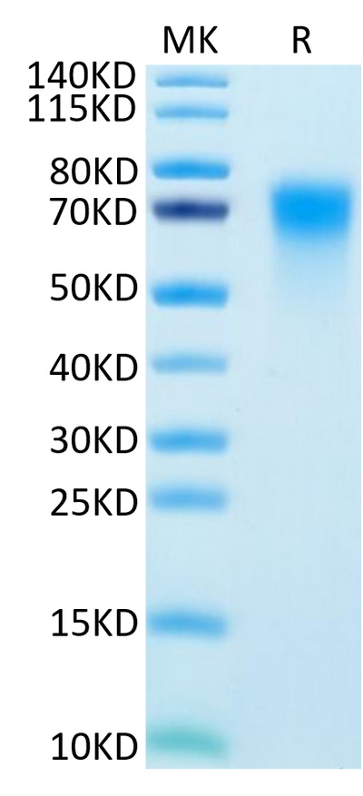 Human DR6 on Tris-Bis PAGE under reduced condition. The purity is greater than 95%.Recombinant Human DR6/TNFRSF21 Protein, Active
