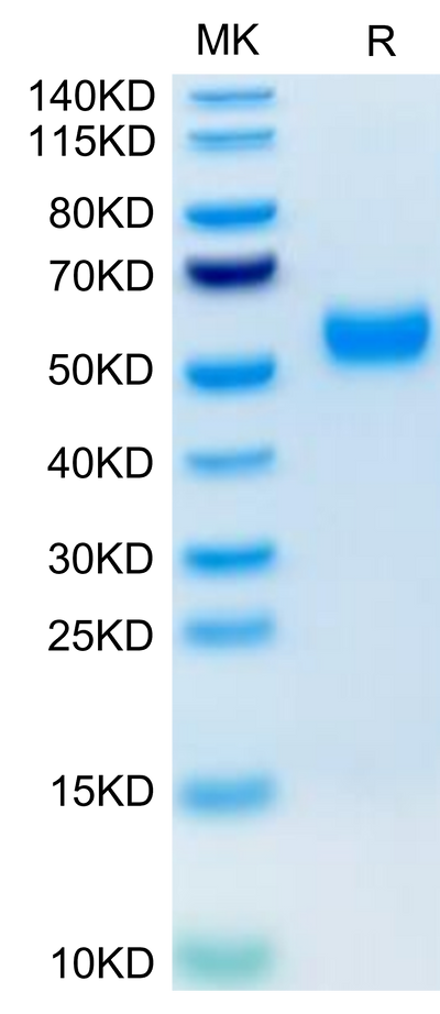 Human AMHRII on Tris-Bis PAGE under reduced condition. The purity is greater than 95%.Recombinant Human AMHRII Protein, Active