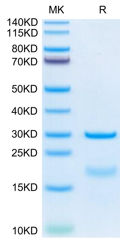 Human HPN on Tris-Bis PAGE under reduced condition. The purity is greater than 95%.Recombinant Human HPN Protein, Active