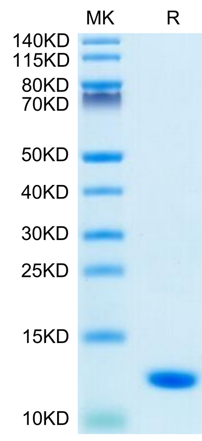 Human S100A8 on Tris-Bis PAGE under reduced condition. The purity is greater than 95%.Recombinant Human S100A8 Protein