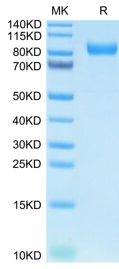 Human Kremen-1 on Tris-Bis PAGE under reduced condition. The purity is greater than 95%.Recombinant Human Kremen-1 Protein