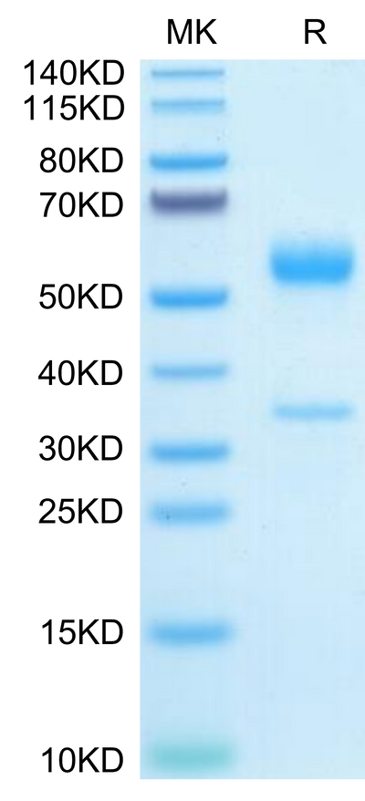 Mouse PGF on Tris-Bis PAGE under reduced condition. The purity is greater than 95%.Recombinant Mouse PGF Protein