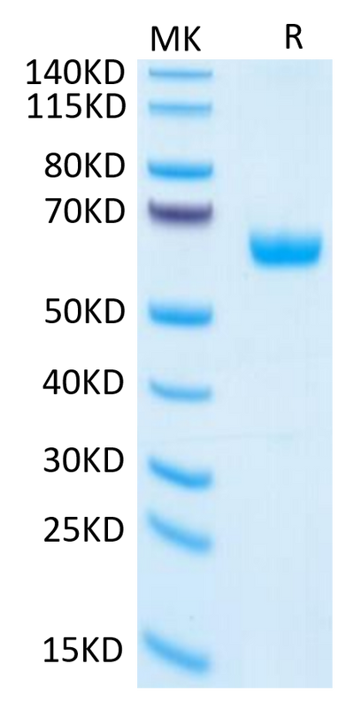 Human PGF on Tris-Bis PAGE under reduced condition. The purity is greater than 95%.Recombinant Human PGF Protein, Active