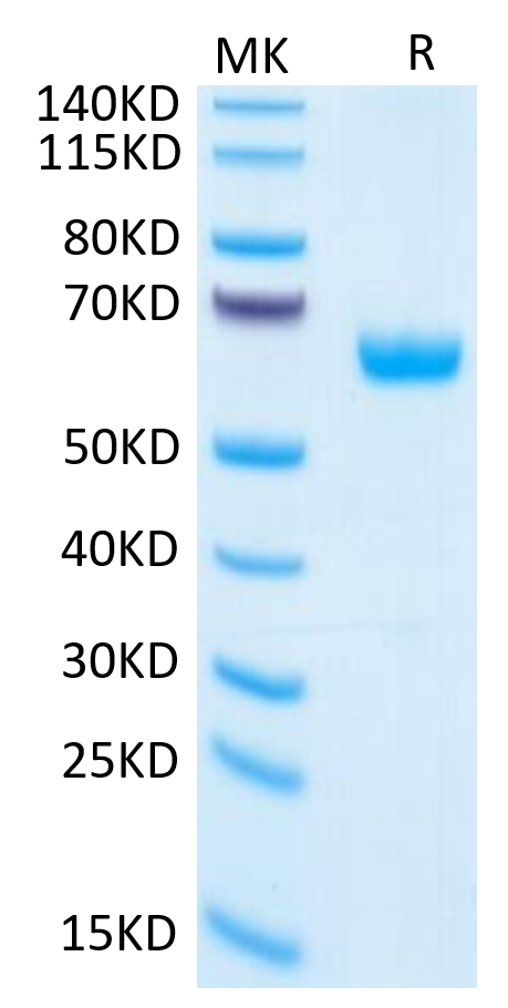 Human PGF on Tris-Bis PAGE under reduced condition. The purity is greater than 95%.Recombinant Human PGF Protein, Active