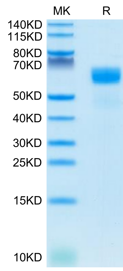 Human SG3 on Tris-Bis PAGE under reduced condition. The purity is greater than 95%.Recombinant Human SG3/Secretogranin 3 Protein, Active