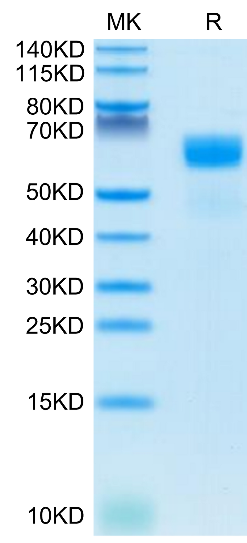 Human SG3 on Tris-Bis PAGE under reduced condition. The purity is greater than 95%.Recombinant Human SG3/Secretogranin 3 Protein, Active