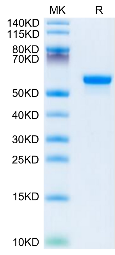 Human LGMN on Tris-Bis PAGE under reduced condition. The purity is greater than 95%.Recombinant Human LGMN Protein