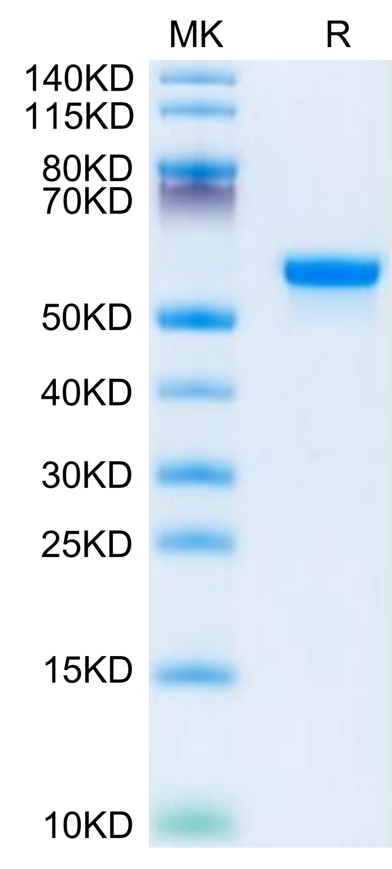 Human LGMN on Tris-Bis PAGE under reduced condition. The purity is greater than 95%.Recombinant Human LGMN Protein