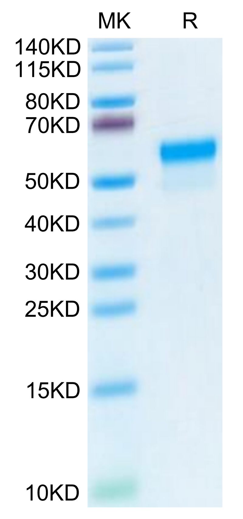 Mouse LGMN on Tris-Bis PAGE under reduced condition. The purity is greater than 95%.Recombinant Mouse LGMN Protein