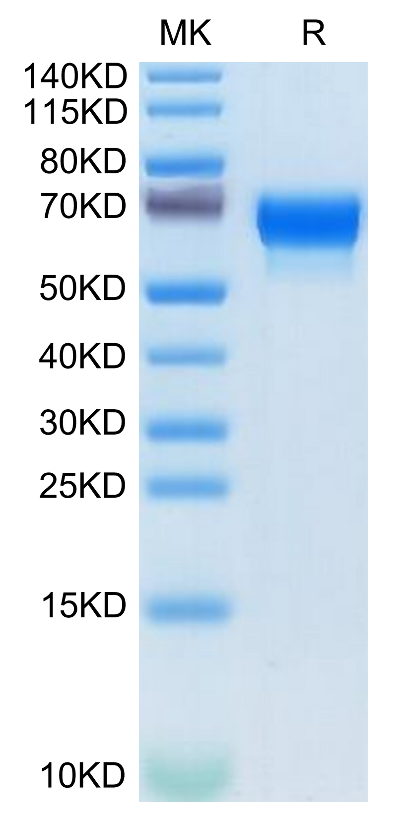 Mouse SERPINF2 on Tris-Bis PAGE under reduced condition. The purity is greater than 95%.Recombinant Mouse SERPINF2/A2AP Protein