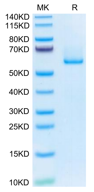 Human EFEMP1 on Tris-Bis PAGE under reduced condition. The purity is greater than 95%.Recombinant Human EFEMP1 Protein, Active