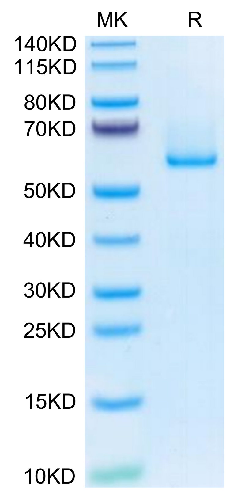 Human EFEMP1 on Tris-Bis PAGE under reduced condition. The purity is greater than 95%.Recombinant Human EFEMP1 Protein, Active