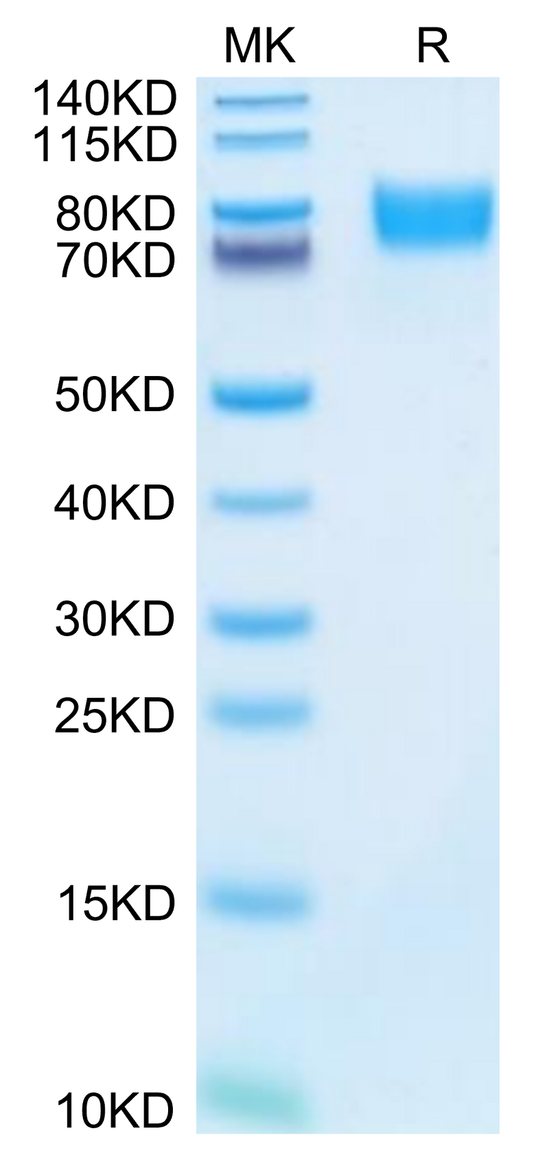Mouse ALCAM on Tris-Bis PAGE under reduced condition. The purity is greater than 95%.Recombinant Mouse ALCAM/CD166 Protein