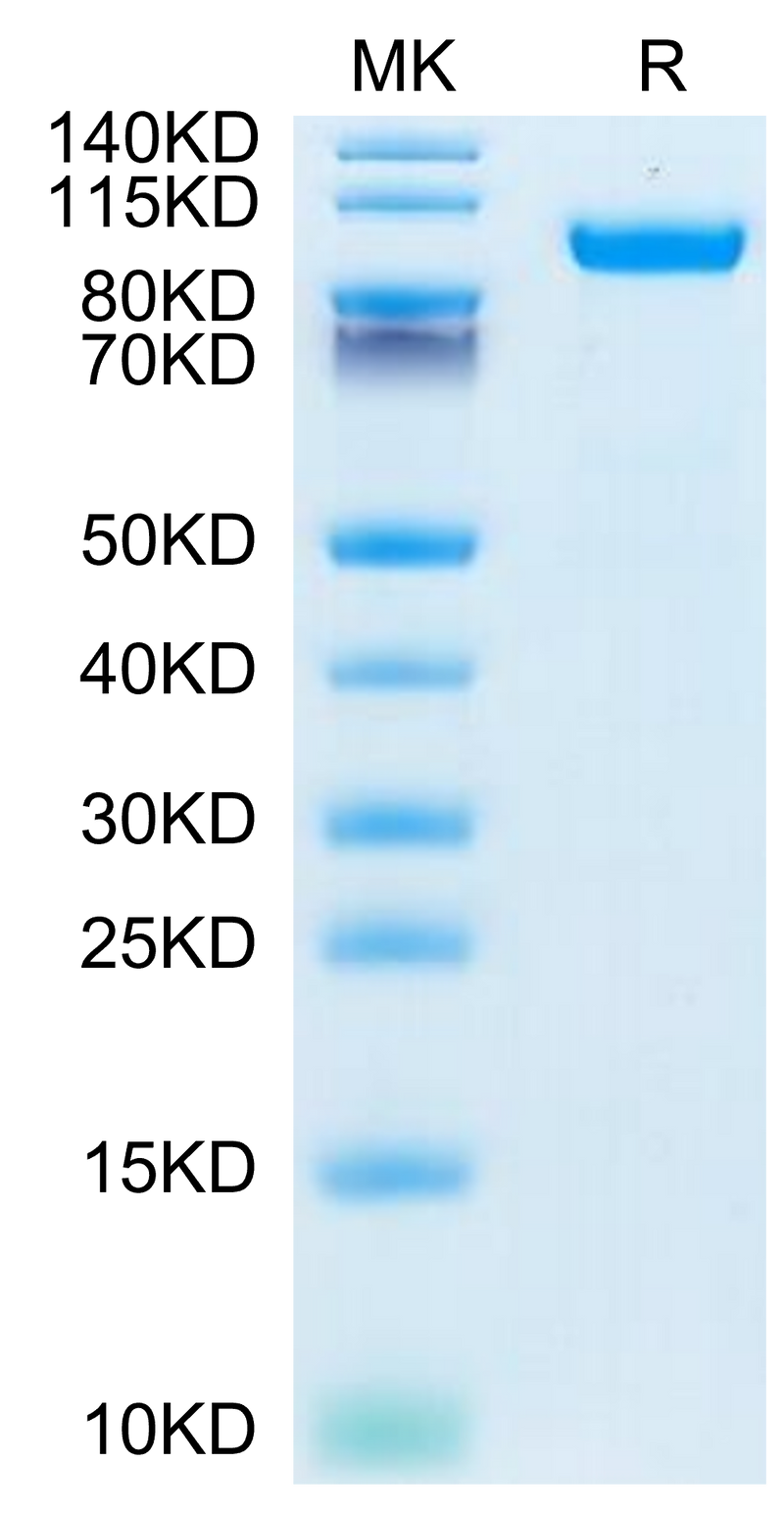 Human HGFA (pro form) on Tris-Bis PAGE under reduced condition. The purity is greater than 95%.Recombinant Human HGFA Protein (pro form)