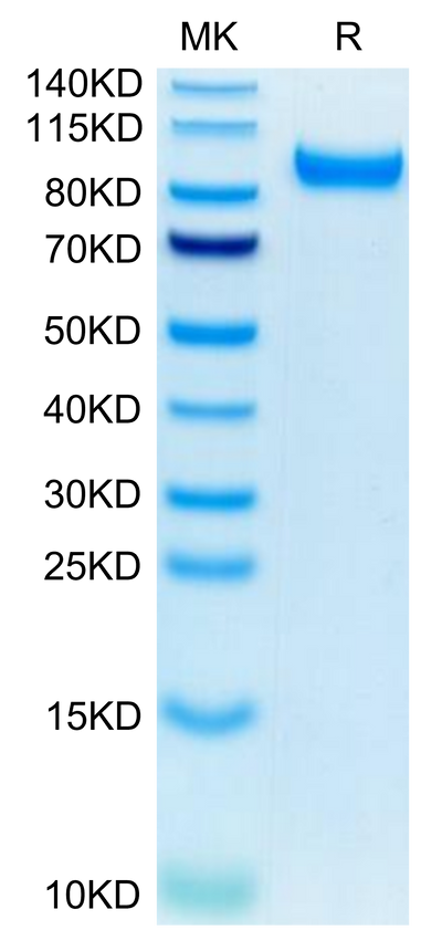 Mouse HGFA (pro form) on Tris-Bis PAGE under reduced condition. The purity is greater than 95%.Recombinant Mouse HGFA Protein (pro form)