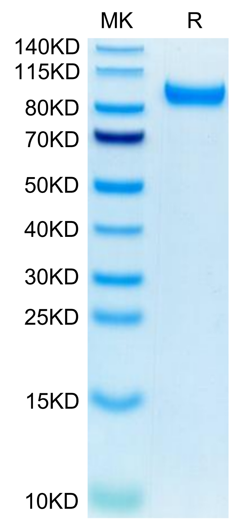 Mouse HGFA (pro form) on Tris-Bis PAGE under reduced condition. The purity is greater than 95%.Recombinant Mouse HGFA Protein (pro form)