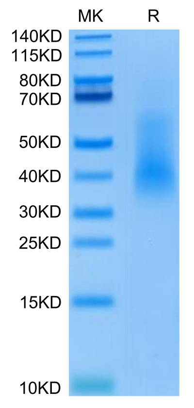 Human Rankl on Tris-Bis PAGE under reduced condition. The purity is greater than 90%.Recombinant Human RANKL/TNFSF11/CD254 Protein, Active