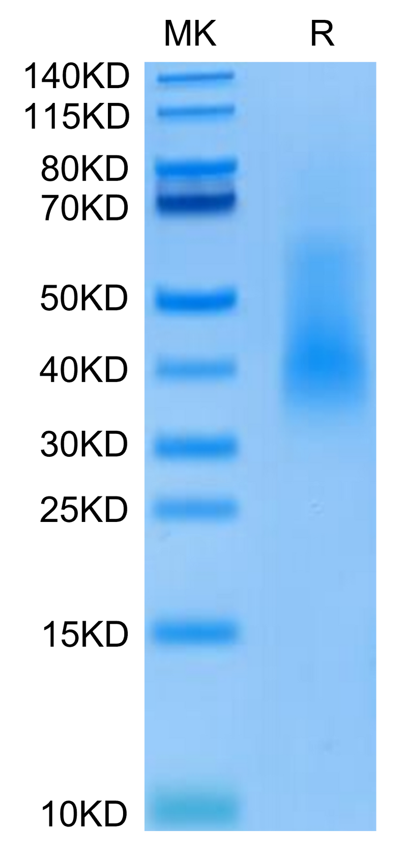 Human Rankl on Tris-Bis PAGE under reduced condition. The purity is greater than 90%.Recombinant Human RANKL/TNFSF11/CD254 Protein, Active