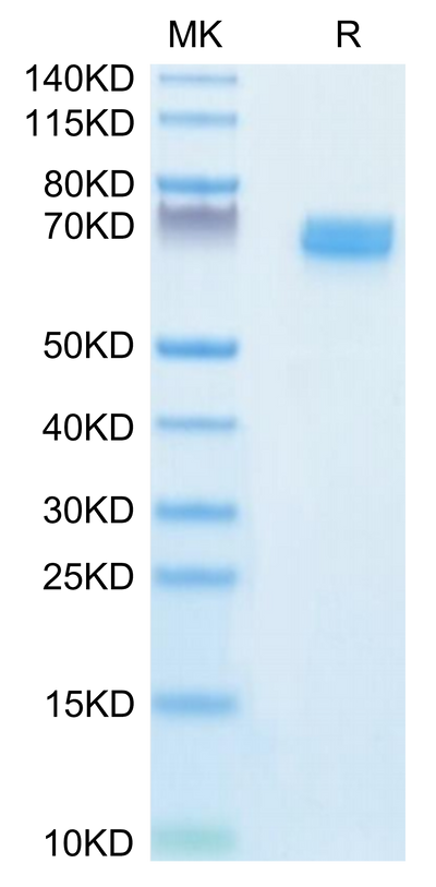 Human EPHB2 on Tris-Bis PAGE under reduced condition. The purity is greater than 95%.Recombinant Mouse EPHB2 Protein