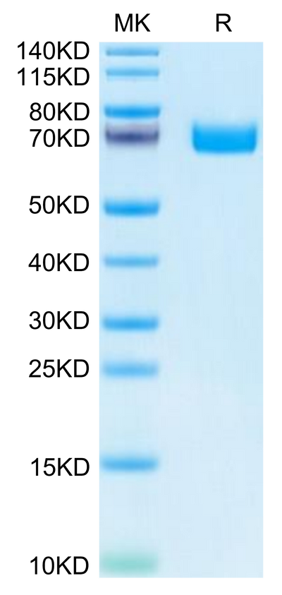 Human EPHB2 on Tris-Bis PAGE under reduced condition. The purity is greater than 95%.Recombinant Human EPHB2 Protein, Active