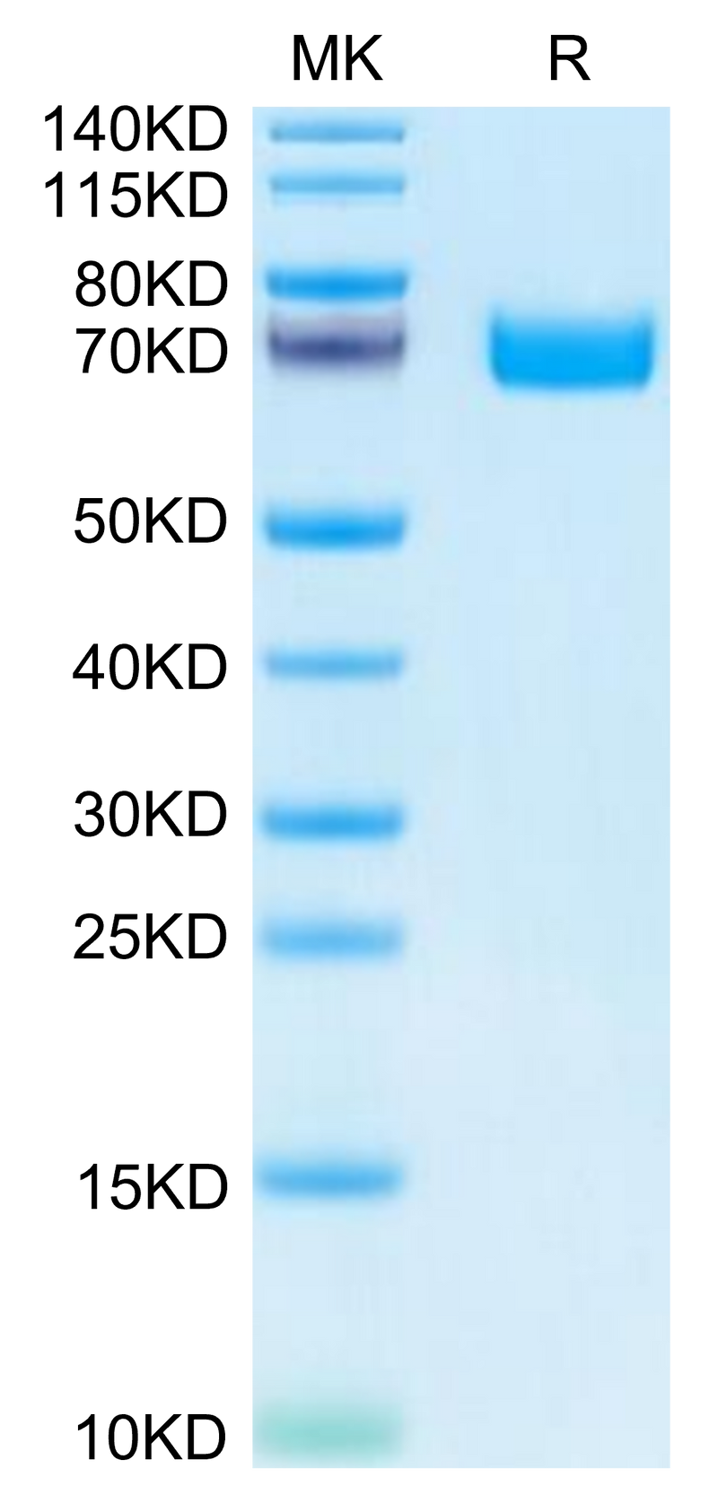 Human EPHB2 on Tris-Bis PAGE under reduced condition. The purity is greater than 95%.Recombinant Human EPHB2 Protein, Active