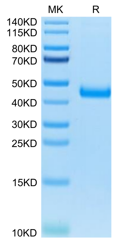Mouse IL-17RB on Tris-Bis PAGE under reduced condition. The purity is greater than 95%.Recombinant Mouse IL-17RB Protein