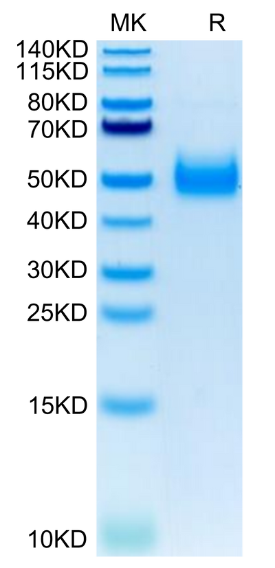 Human IL-17RB on Tris-Bis PAGE under reduced condition. The purity is greater than 95%.Recombinant Human IL-17RB Protein, Active