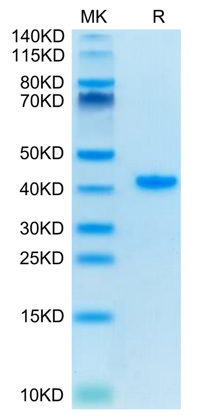 Human TFF1 on Tris-Bis PAGE under reduced condition. The purity is greater than 95%.Recombinant Human TFF1 Protein