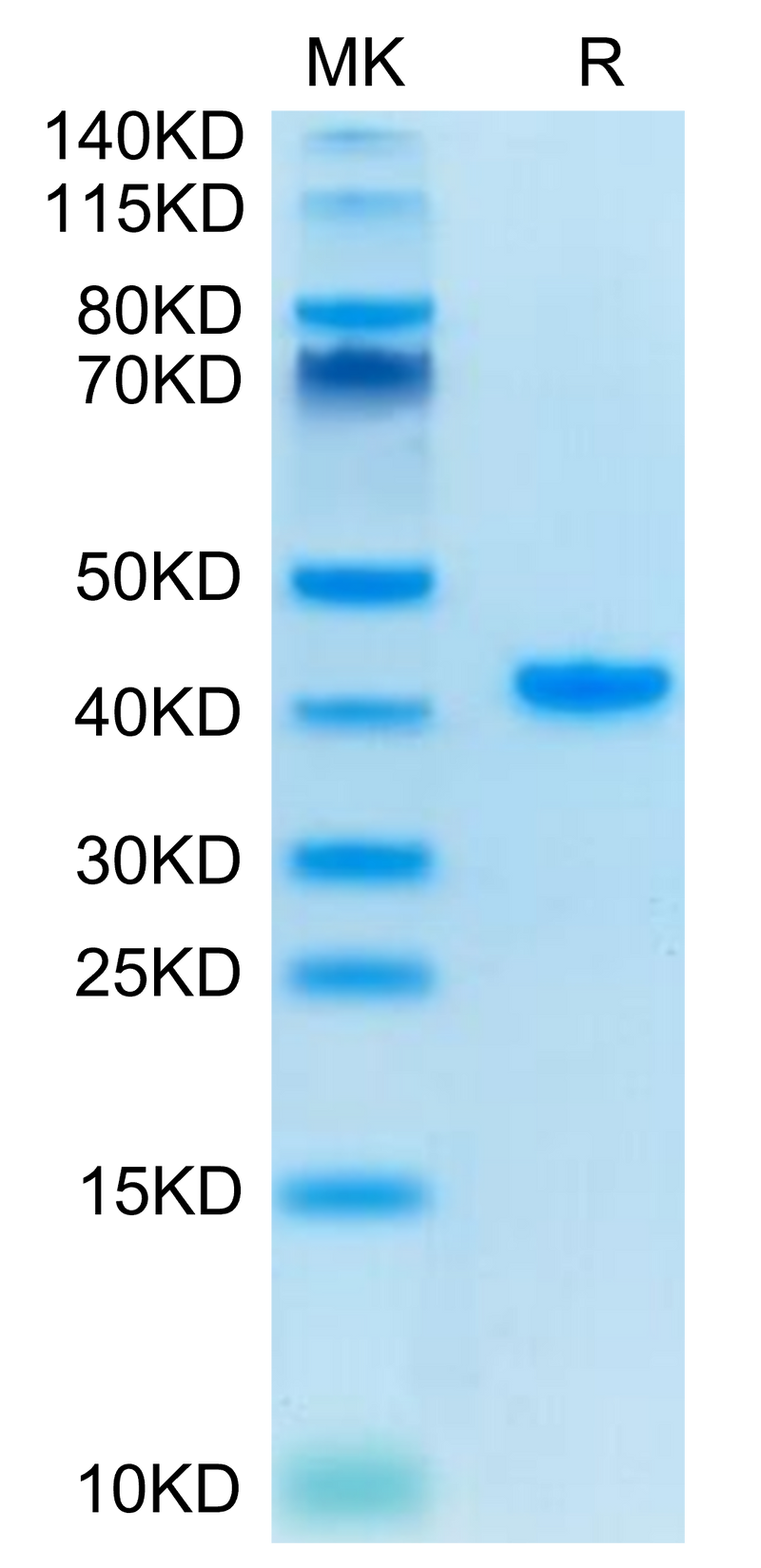 Human TFF1 on Tris-Bis PAGE under reduced condition. The purity is greater than 95%.Recombinant Human TFF1 Protein