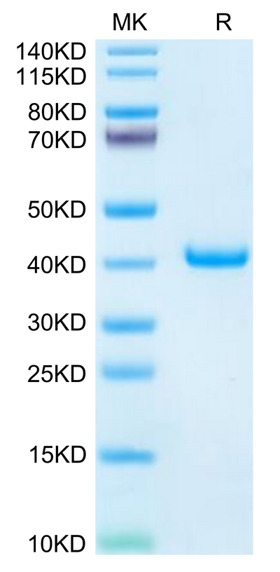 Mouse TFF1 on Tris-Bis PAGE under reduced condition. The purity is greater than 95%.Recombinant Mouse TFF1 Protein