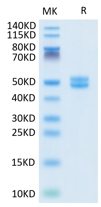 Human Galectin 1 on Tris-Bis PAGE under reduced condition. The purity is greater than 95%.Recombinant Human Galectin 1 Protein, Active
