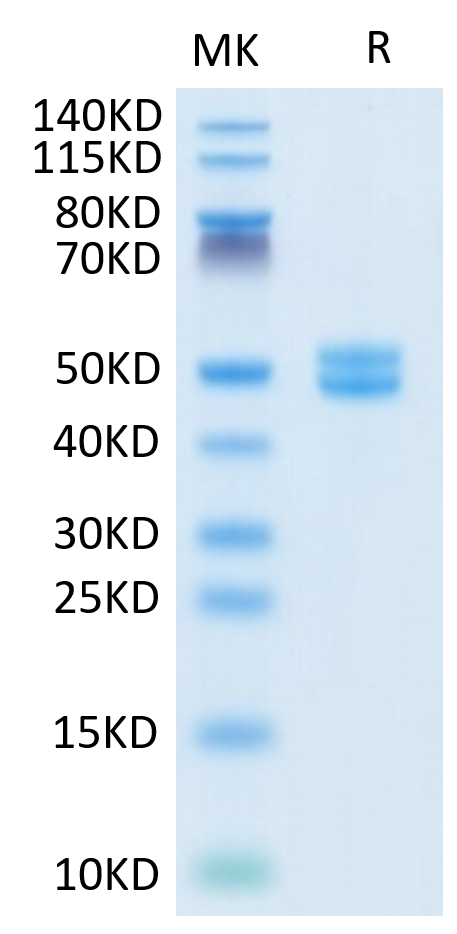 Human Galectin 1 on Tris-Bis PAGE under reduced condition. The purity is greater than 95%.Recombinant Human Galectin 1 Protein, Active