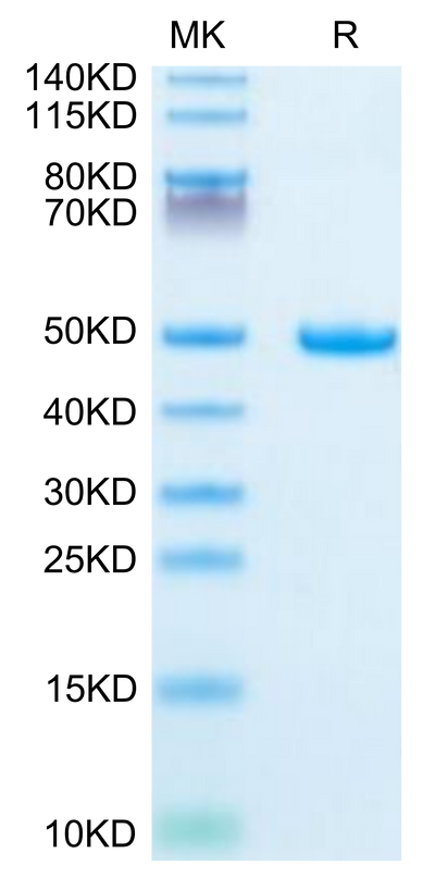 Mouse Galectin 1 on Tris-Bis PAGE under reduced condition. The purity is greater than 95%.Recombinant Mouse Galectin 1 Protein