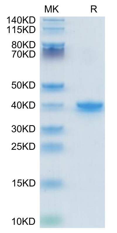 Mouse TGF-alpha on Tris-Bis PAGE under reduced condition. The purity is greater than 95%.Recombinant Mouse TGF-alpha Protein